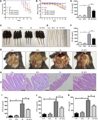 Autophagy Induced by Micheliolide Alleviates Acute Irradiation-Induced Intestinal Injury via Inhibition of the NLRP3 Inflammasome